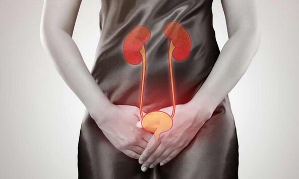 Causes et traitement de la cystite chez les femmes