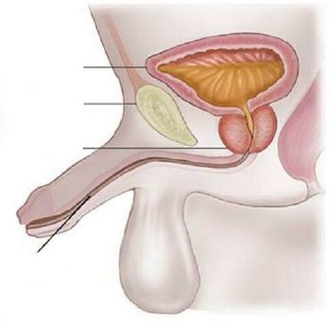 Cystite chez les hommes