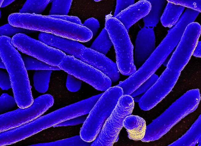 E. coli provoque très souvent le développement de cystites chez les femmes